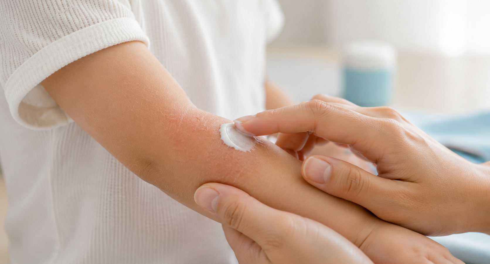 Eczéma et allergie : quel lien chez l’enfant ?