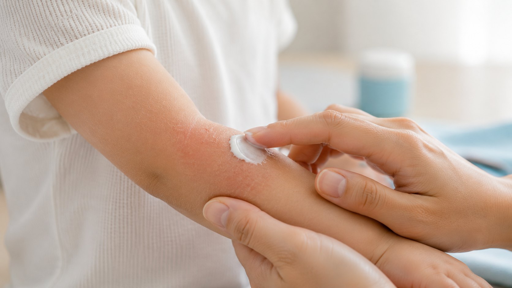 Eczéma et allergie : quel lien chez l’enfant ?